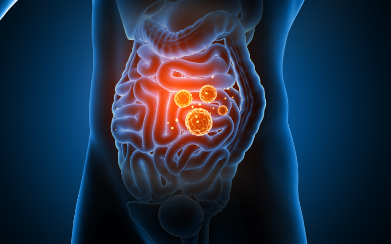 A human intestinal tract against a blue background with inflammation and gut bacteria depicted