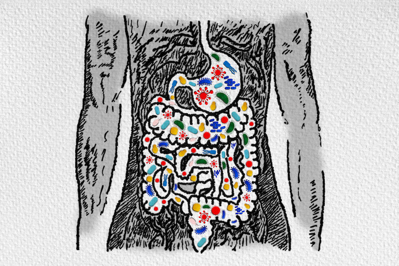 ut Microbiome and Probiotics - Association with Gastrointestinal Diseases - Leaky Gut - Dysbiosis