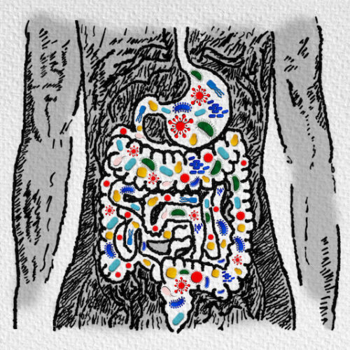 ut Microbiome and Probiotics - Association with Gastrointestinal Diseases - Leaky Gut - Dysbiosis